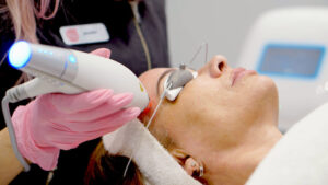 melasma treatment in islamabad